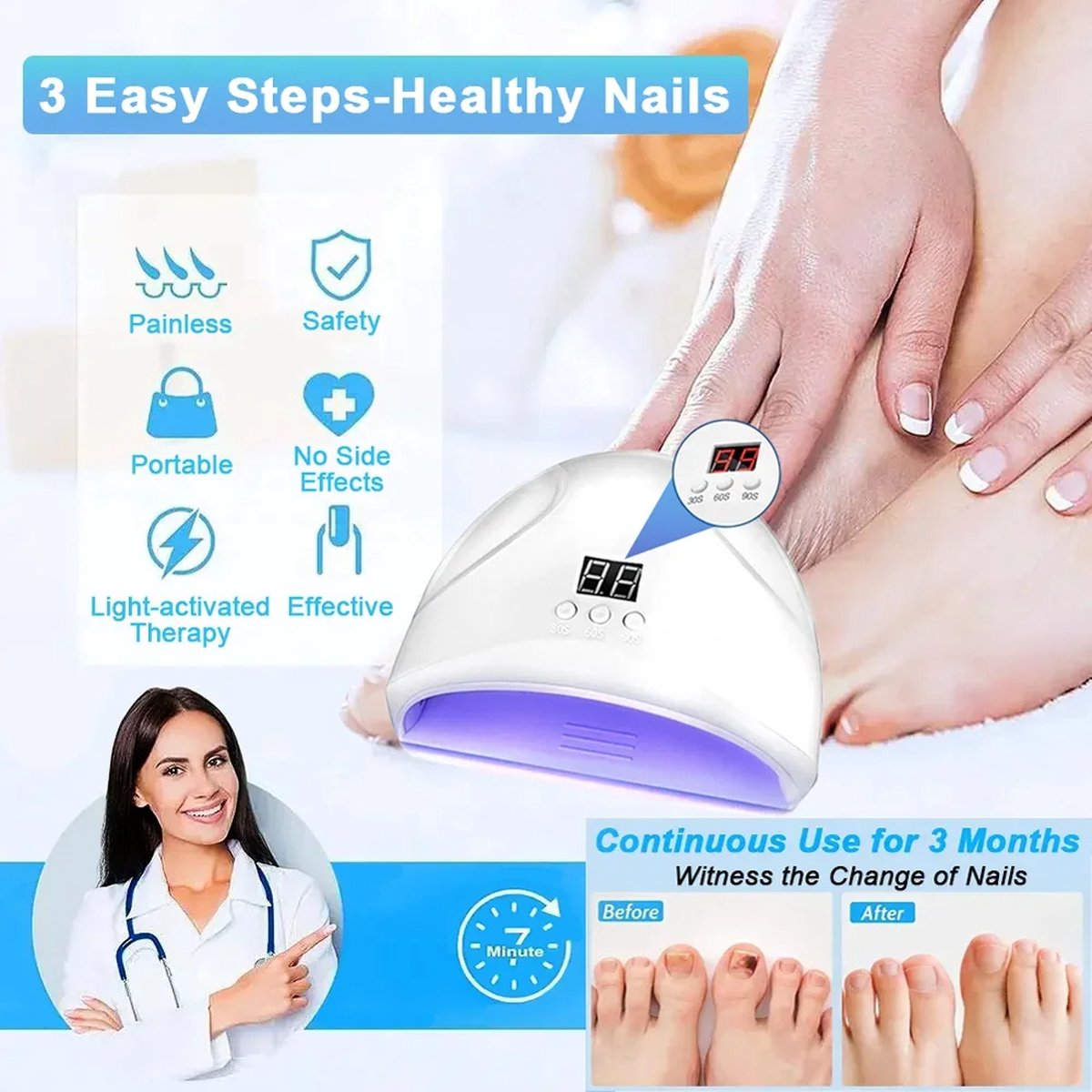 Schimmel Nagellaserapparaat Nagels Schimmel Snelle Reparatie Gezonde Teennagels Vingernagels Verwijdert Nagelschimmel Voetverzorging Kuur Ingegroeide Anti Nagel Schimmel