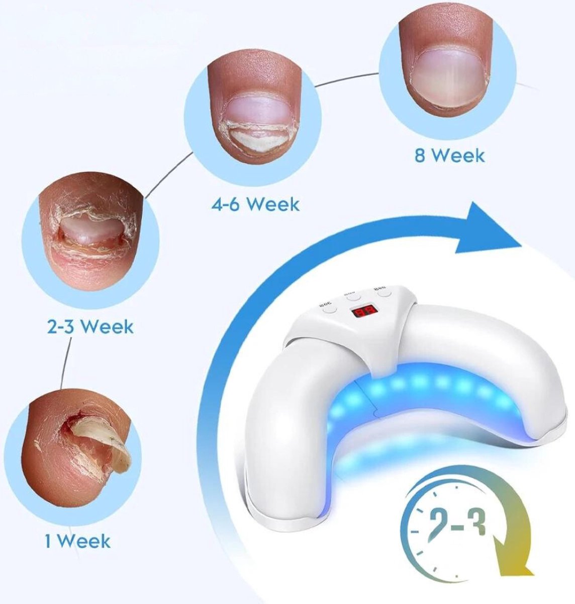 Toenail Fungus Treatment - 5-IN-1 - Nail Fungus Treatment - Nail Fungus Products - Laser - Whole Foot - Wireless - White