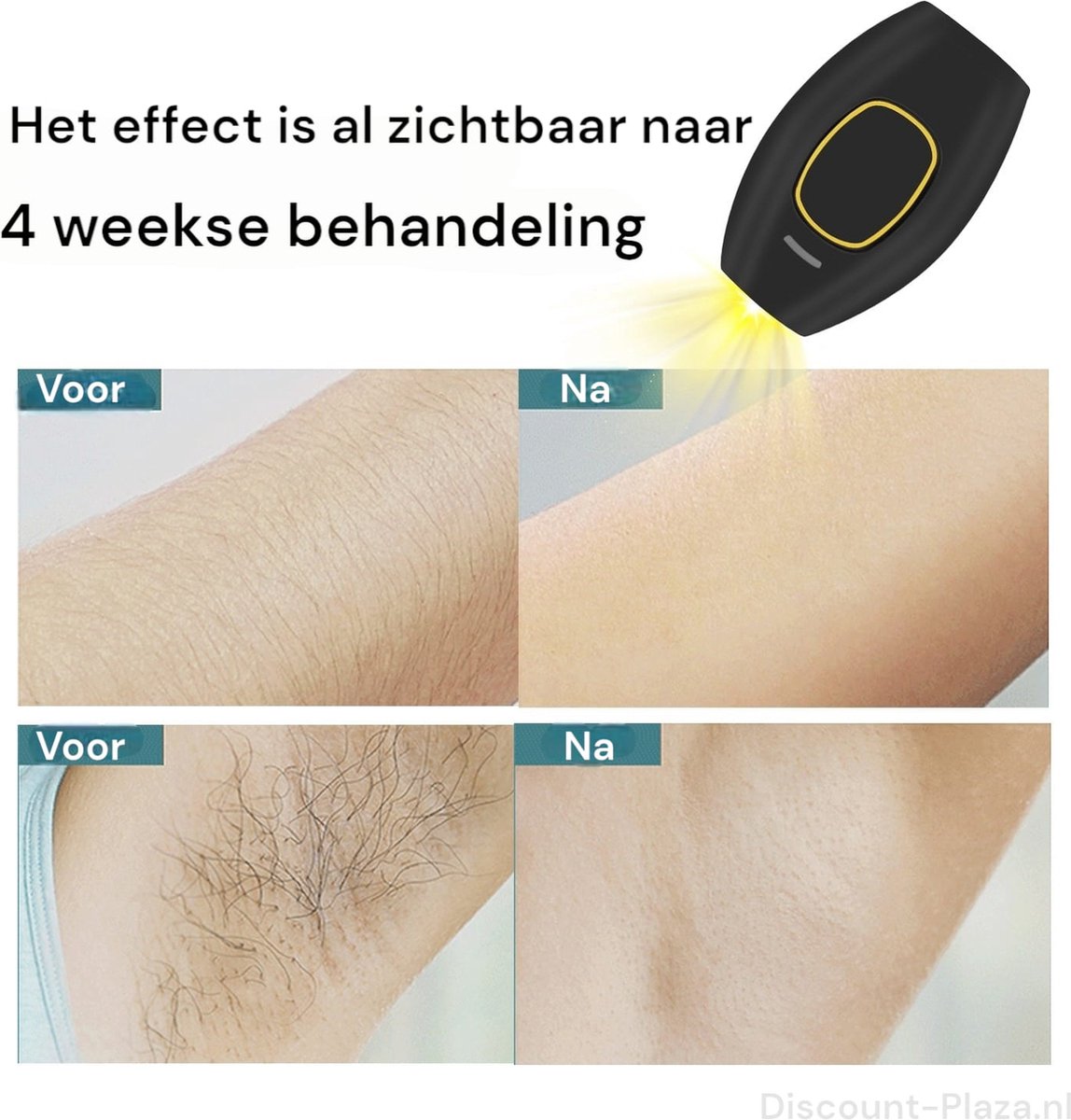 IPL ontharingsapparaat - Laser ontharing - Laser en lichtontharing - Inclusief GRATIS beschermbril - Roze