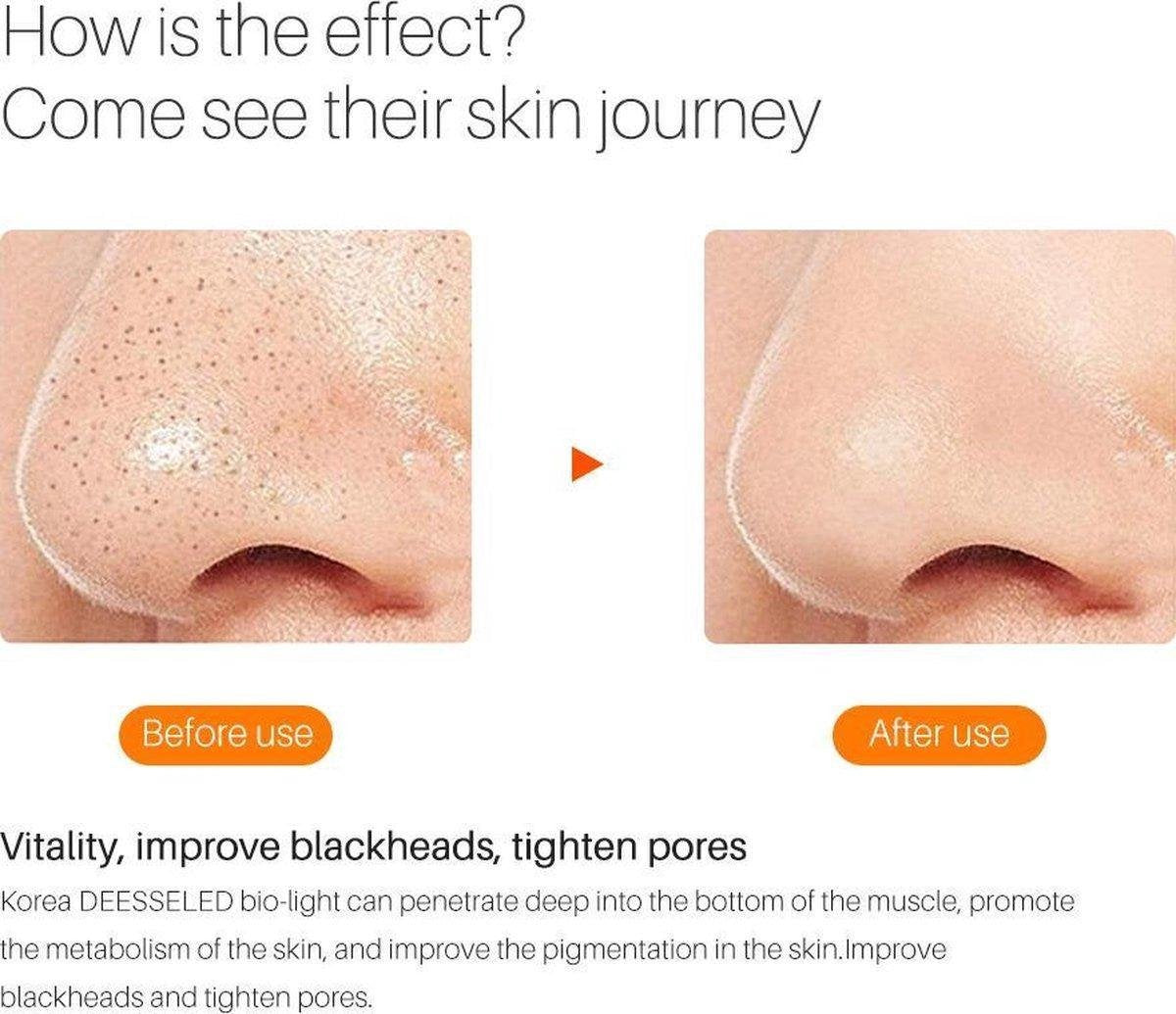 VENEUX® - LED gezichtsmasker - LED masker - Huidverzorging - Lichttherapie