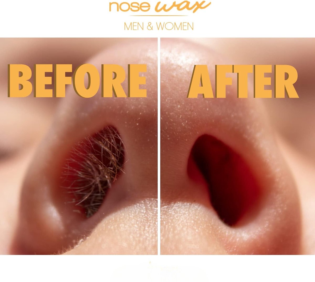 Neuswax - Neus Wax - Neuswax Kit - Haarverwijderaar - Ontharingswax - Neushaarwax