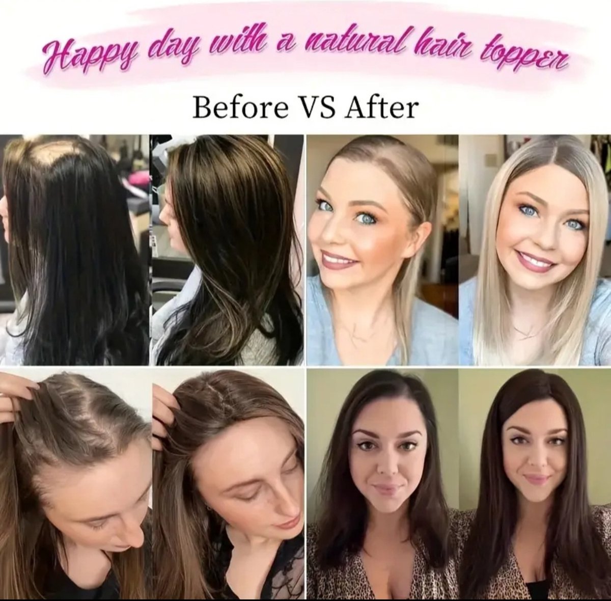 Beautiful natural looking hair topper hair extensions wig for thinning hair or to cover bald spots or gray hair. Color dark brown black brown long model
