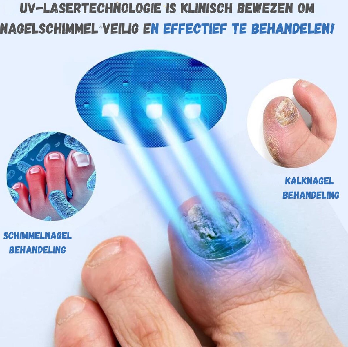 Toenail Fungus Treatment - 5-IN-1 - Nail Fungus Treatment - Nail Fungus Products - Laser - Whole Foot - Wireless - White