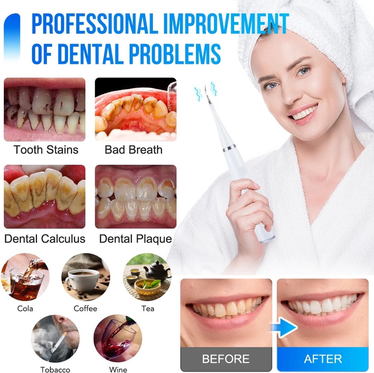 Bolmans - Electric Sonic Dental Scaler - Tartar Remover - Teeth Cleaning - Teeth Whitening - Toothbrush - Tartar Remover - Incl. 4 Tartar Hooks Oral Care