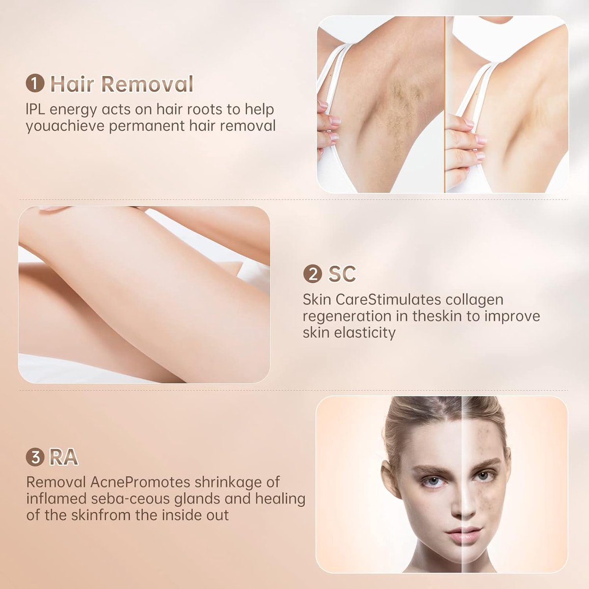 IPL Ontharingsapparaat - 999.900 flitsen - Ontharing - Laser en Lichtontharing - voor Mannen en Vrouwen