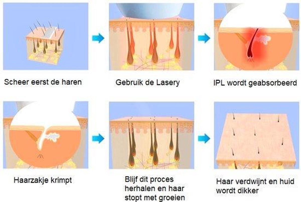 2-in-1 Lichtontharingsapparaat – IPL - Kwartslamp - 700.000 Flitsen - Permanente Haarverwijdering - Laser ontharingsapparaat - Permanente Haarverwijdering