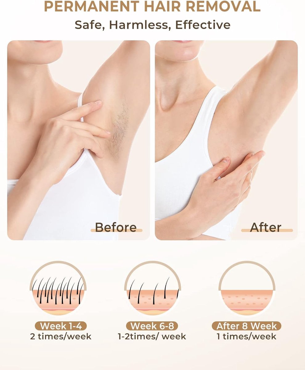 IPL Hair Removal Device - 999,900 Flashes - Epilator - Laser and Light Hair Removal - for Men and Women