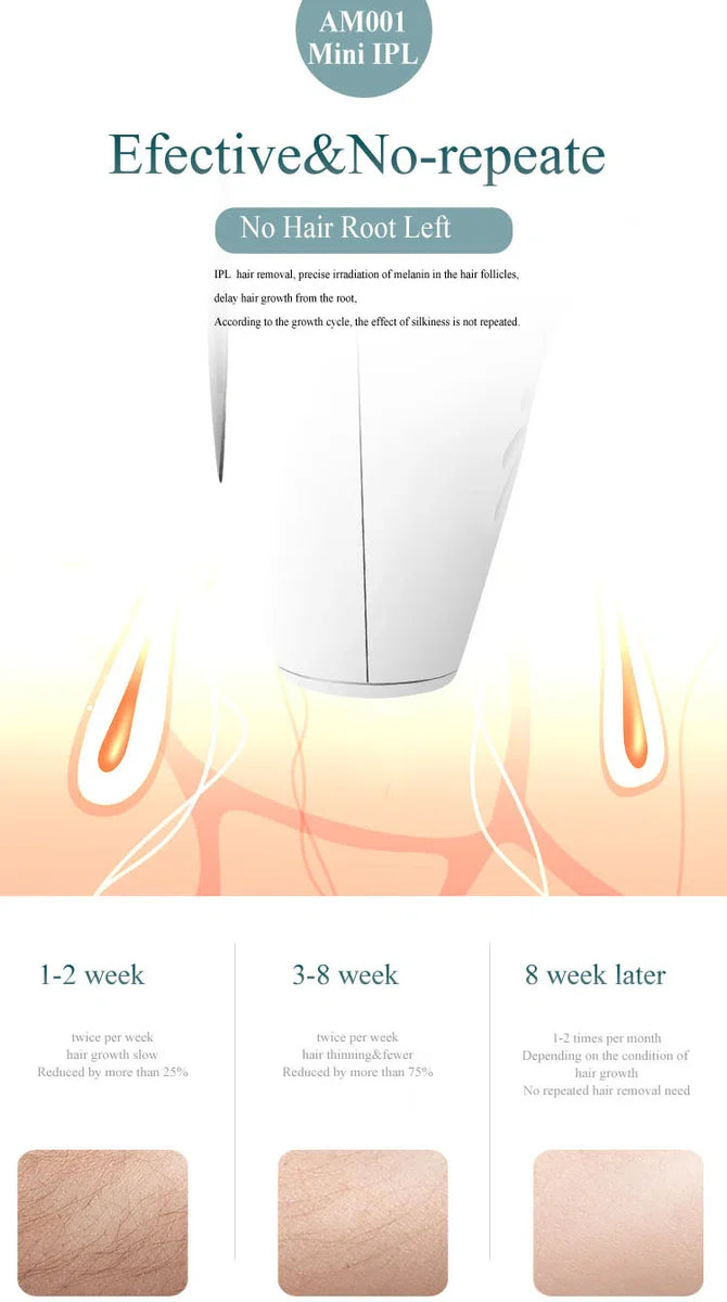 IPL Hair Removal Device - Laser Hair Removal with Protective Goggles and Razor - 900000 Flashes - Painless - Dutch Manual - White
