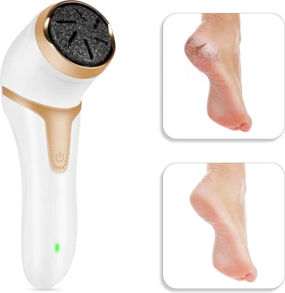 Elektrische Eeltverwijderaar - Dode Huidverwijderaar - Eeltvijl - USB Oplaadbaar - Voetvijl - Draadloos - Waterdicht - Pedicure en Voetverzorging - Wit/Zilver
