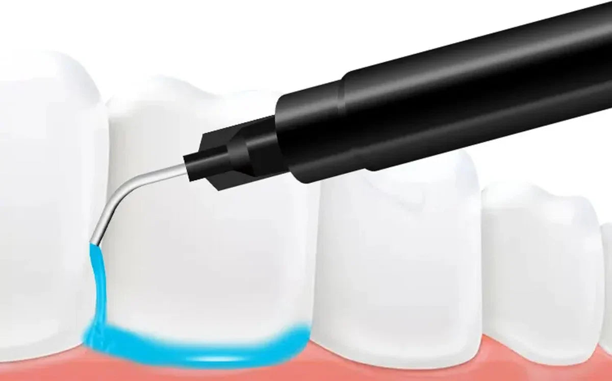 3 ML Gum Protector - 10 Stuks - voor het bleken van tanden