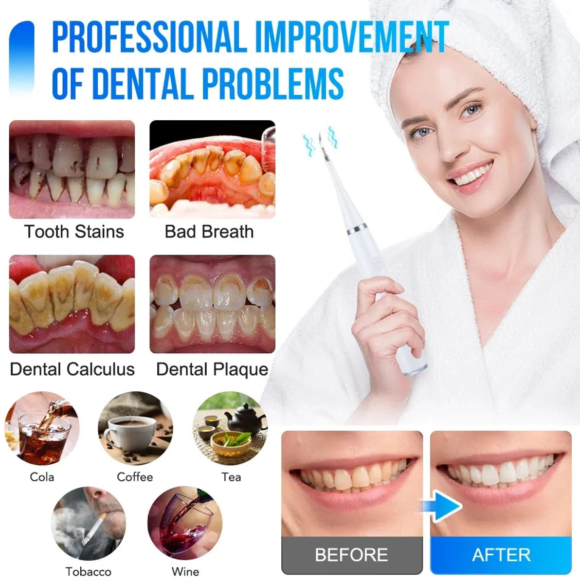 Bolmans - Electric Sonic Dental Scaler - Tartar Remover - Teeth Cleaning - Teeth Whitening - Toothbrush - Tartar Remover - Incl. 4 Tartar Hooks Oral Care