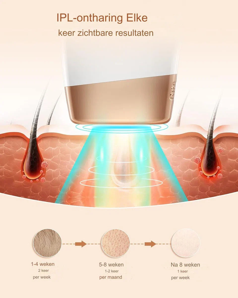 IPL Laser Hair Removal Device with 999,900 Flashes - 9 Energy Levels - Large Treatment Area 4 cm² - Painless Hair Removal for Men and Women - Includes Skin Rejuvenation and Acne Treatment - Suitable for Face, Body, Bikini Line and Armpits